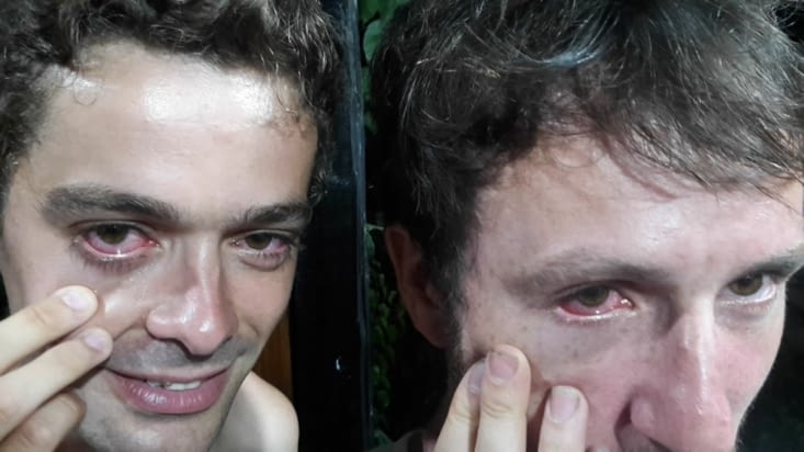 La conjonctivite post-carnaval